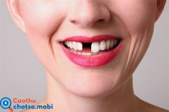 Nằm mơ thấy rụng răng dự báo điều gì? Hên hay xui?