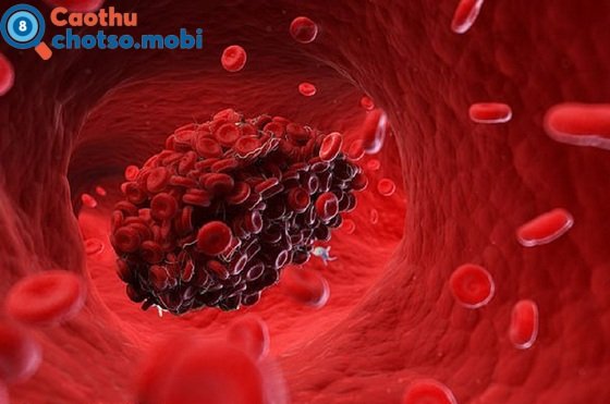 Chiêm bao thấy máu (huyết) là điềm hên hay xui?